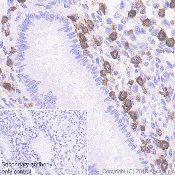 Immunohistochemistry (Formalin/PFA-fixed paraffin-embedded sections) - Anti-KIR2DL3 antibody [EPR22192] - BSA and Azide free (AB241538)