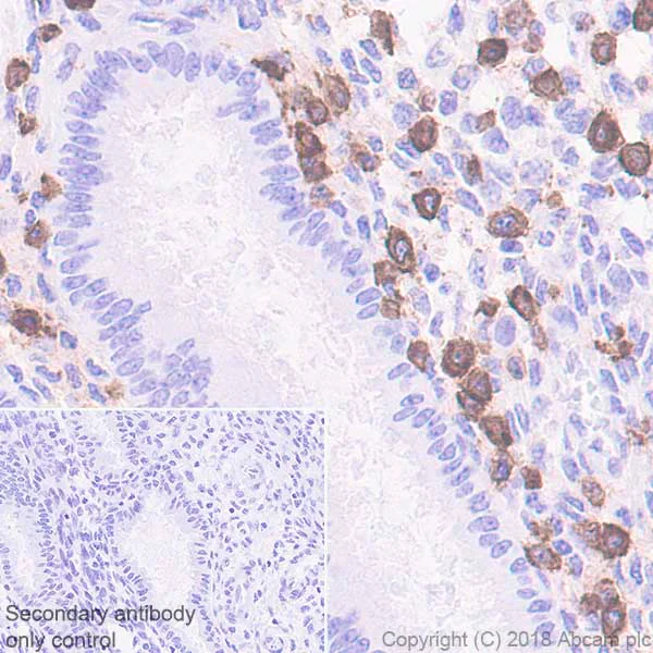 Immunohistochemistry (Formalin/PFA-fixed paraffin-embedded sections) - Anti-KIR2DL3 antibody [EPR22192] - BSA and Azide free (AB241538)