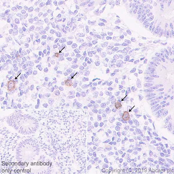 Immunohistochemistry (Formalin/PFA-fixed paraffin-embedded sections) - Anti-KIR2DL3 + KIR2DL1 + KIR2DL2 antibody [EPR22541-47] (AB224697)
