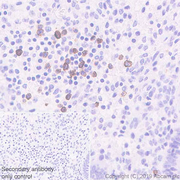 Immunohistochemistry (Formalin/PFA-fixed paraffin-embedded sections) - Anti-KIR2DL3 + KIR2DL1 + KIR2DS2 + KIR2DL2 + KIR2DS1 antibody [EPR22492-64] (AB252938)