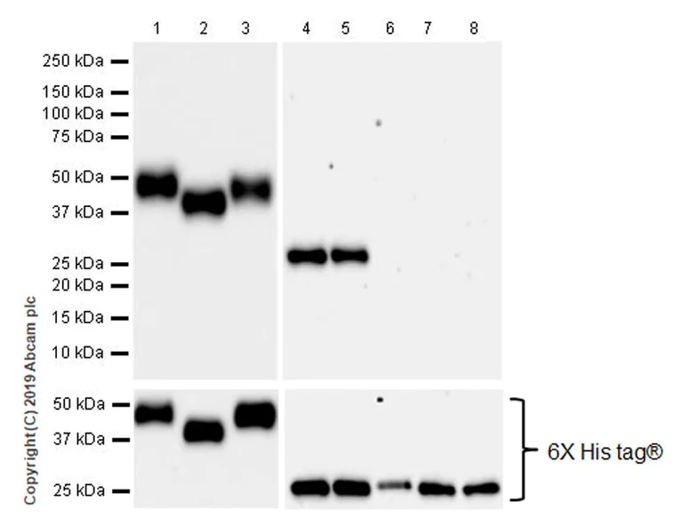 Western blot - Anti-KIR2DL3 + KIR2DL1 + KIR2DS2 + KIR2DL2 + KIR2DS1 antibody [EPR22492-64] (AB252938)