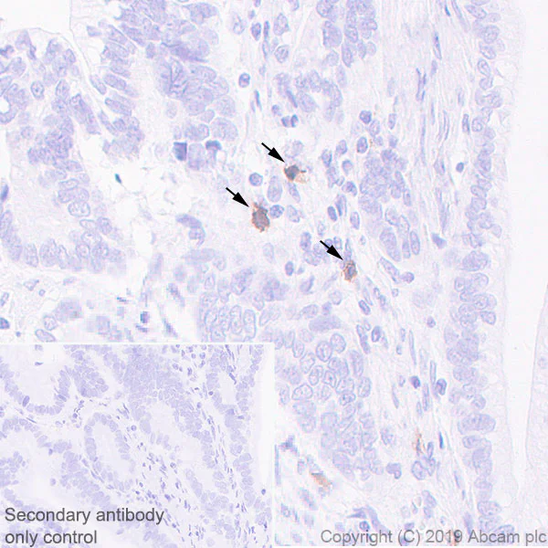 Immunohistochemistry (Formalin/PFA-fixed paraffin-embedded sections) - Anti-KIR2DL3 + KIR2DL1 + KIR2DS2 + KIR2DL2 + KIR2DS1 antibody [EPR22492-64] - BSA and Azide free (AB255327)