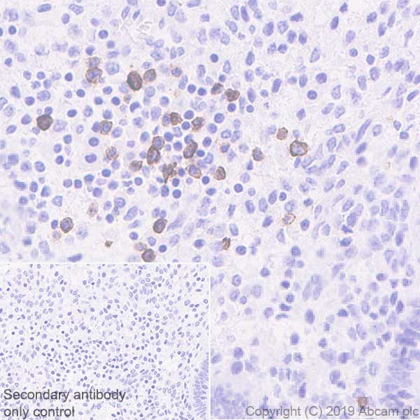 Immunohistochemistry (Formalin/PFA-fixed paraffin-embedded sections) - Anti-KIR2DL3 + KIR2DL1 + KIR2DS2 + KIR2DL2 + KIR2DS1 antibody [EPR22492-64] - BSA and Azide free (AB255327), expandable thumbnail