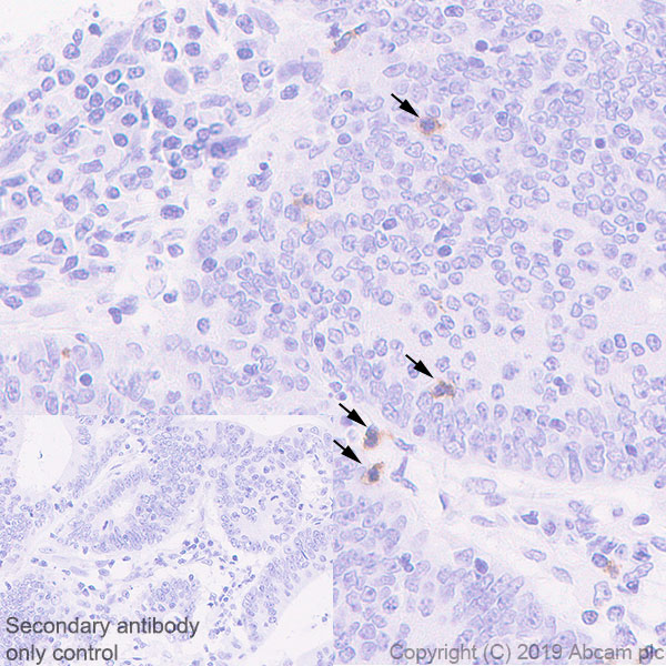 Immunohistochemistry (Formalin/PFA-fixed paraffin-embedded sections) - Anti-KIR2DL3 + KIR2DL1 + KIR2DS2 + KIR2DL2 + KIR2DS1 antibody [EPR22492-64] - BSA and Azide free (AB255327), expandable thumbnail