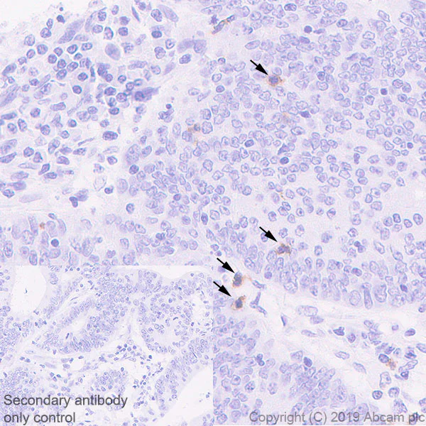 Immunohistochemistry (Formalin/PFA-fixed paraffin-embedded sections) - Anti-KIR2DL3 + KIR2DL1 + KIR2DS2 + KIR2DL2 + KIR2DS1 antibody [EPR22492-64] - BSA and Azide free (AB255327)