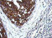 Immunohistochemistry (Formalin/PFA-fixed paraffin-embedded sections) - Anti-KIR2DS4 antibody (AB126128)