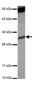 Western blot - Anti-KIR2DS4 antibody (AB126128)