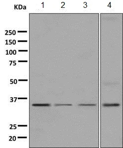 Western blot - Anti-KIR2DS4 antibody [EPR7759] - BSA and Azide free (AB248921)