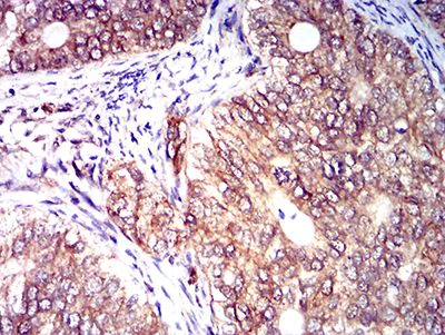 Immunohistochemistry (Formalin/PFA-fixed paraffin-embedded sections) - Anti-KIR3DL1 antibody [2C3B6] (AB233780)