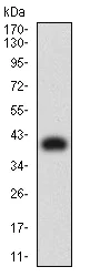 Western blot - Anti-KIR3DL1 antibody [2C3B6] (AB233780)