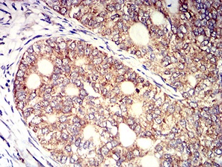Immunohistochemistry (Formalin/PFA-fixed paraffin-embedded sections) - Anti-KIR3DL1 antibody [6D9F6] (AB233740)