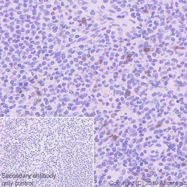 Immunohistochemistry (Formalin/PFA-fixed paraffin-embedded sections) - Anti-KIR3DL1 + KIR3DS1 antibody [EPR22876-121] (AB222100)