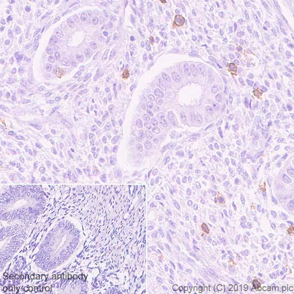 Immunohistochemistry (Formalin/PFA-fixed paraffin-embedded sections) - Anti-KIR3DL1 + KIR3DS1 antibody [EPR22876-121] - BSA and Azide free (AB256542)