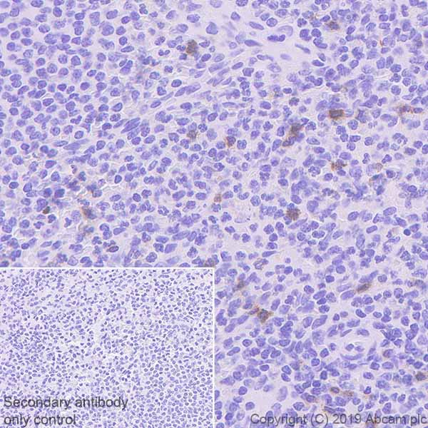 Immunohistochemistry (Formalin/PFA-fixed paraffin-embedded sections) - Anti-KIR3DL1 + KIR3DS1 antibody [EPR22876-121] - BSA and Azide free (AB256542)
