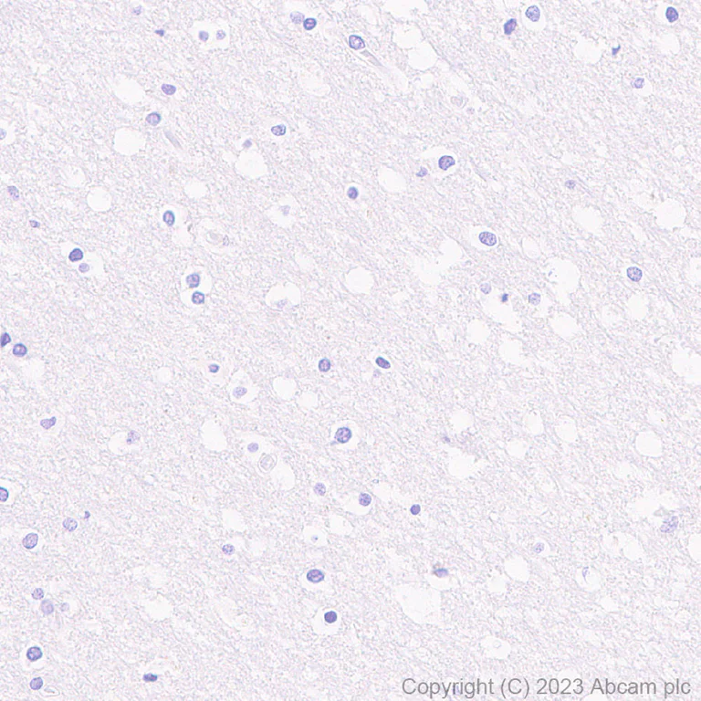 Immunohistochemistry (Formalin/PFA-fixed paraffin-embedded sections) - Anti-KIR3DL1+KIR2DL3+KIR3DL2 antibody [EPR27252-40] (AB314868)