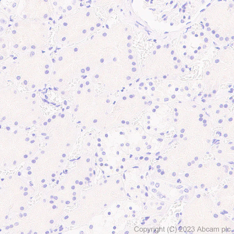Immunohistochemistry (Formalin/PFA-fixed paraffin-embedded sections) - Anti-KIR3DL1+KIR2DL3+KIR3DL2 antibody [EPR27252-40] (AB314868)