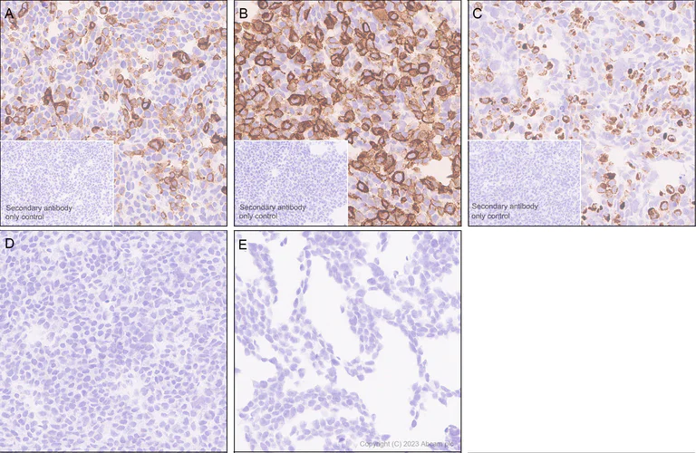 Immunohistochemistry (Formalin/PFA-fixed paraffin-embedded sections) - Anti-KIR3DL1+KIR2DL3+KIR3DL2 antibody [EPR27252-40] (AB314868)