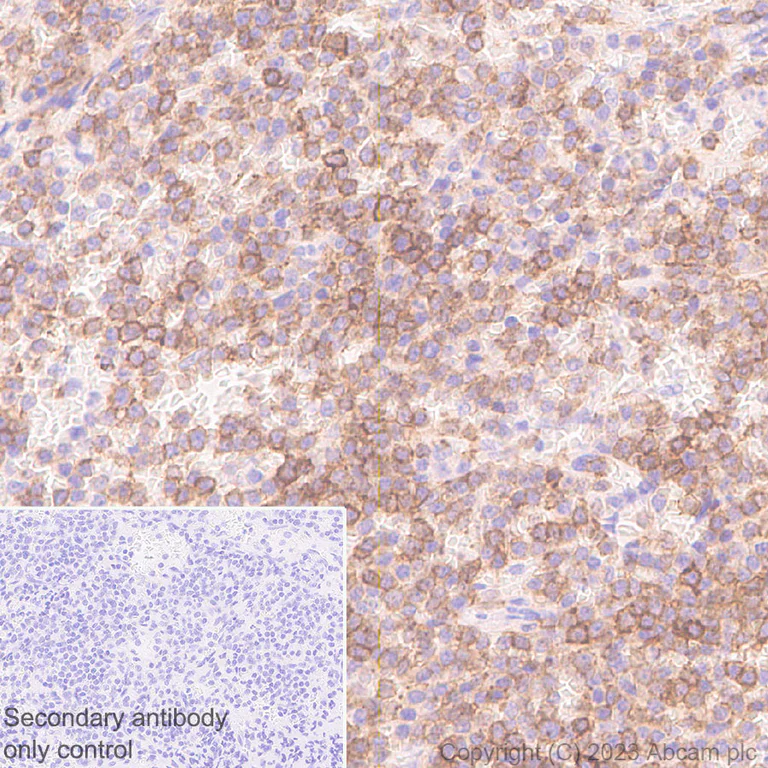 Immunohistochemistry (Formalin/PFA-fixed paraffin-embedded sections) - Anti-KIR3DL1+KIR2DL3+KIR3DL2 antibody [EPR27252-40] - BSA and Azide free (AB314869)