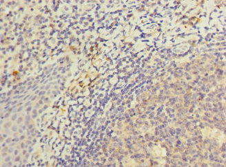 Immunohistochemistry (Formalin/PFA-fixed paraffin-embedded sections) - Anti-KIR3DL3 antibody (AB230299), expandable thumbnail