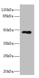 Western blot - Anti-KIR3DL3 antibody (AB230299), expandable thumbnail