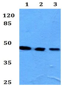 Western blot - Anti-Kir4.1/KCNJ10 antibody (AB192406)