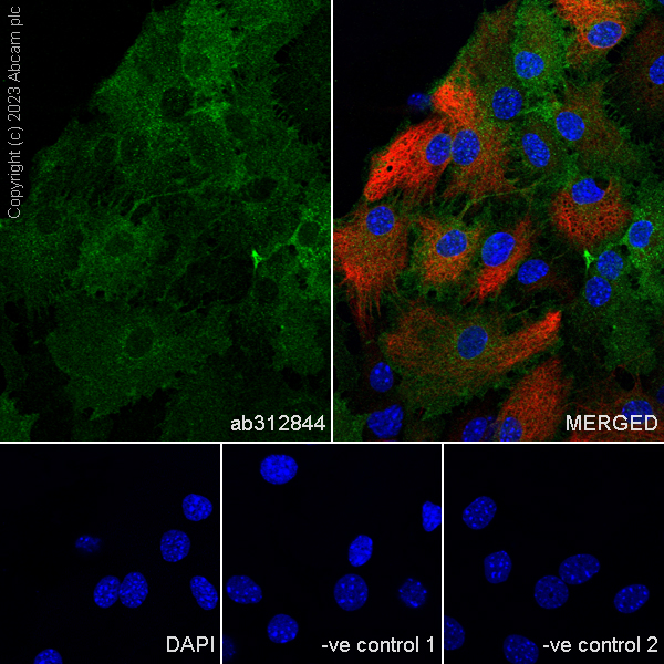 Immunocytochemistry/ Immunofluorescence - Anti-Kir4.1/KCNJ10 antibody [EPR27251-74] (AB312844)