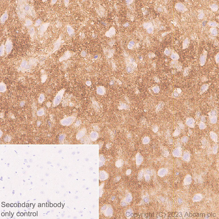 Immunohistochemistry (Formalin/PFA-fixed paraffin-embedded sections) - Anti-Kir4.1/KCNJ10 antibody [EPR27251-74] (AB312844)