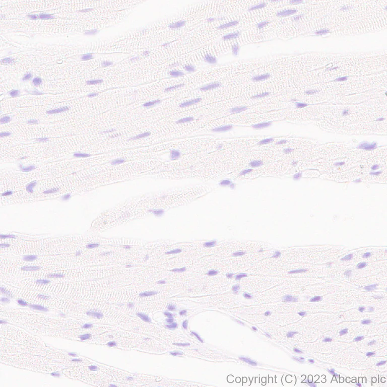 Immunohistochemistry (Formalin/PFA-fixed paraffin-embedded sections) - Anti-Kir4.1/KCNJ10 antibody [EPR27251-74] (AB312844)