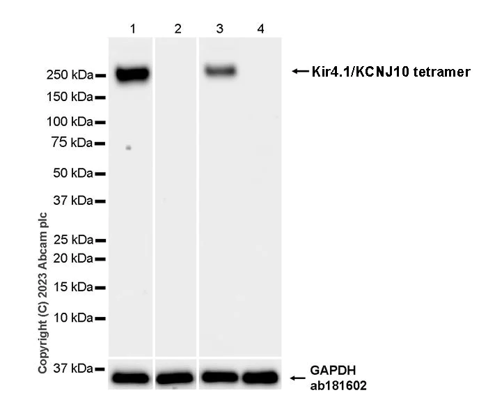 Western blot - Anti-Kir4.1/KCNJ10 antibody [EPR27251-74] (AB312844)