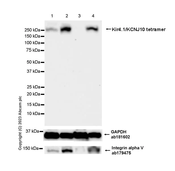 Western blot - Anti-Kir4.1/KCNJ10 antibody [EPR27251-74] (AB312844)