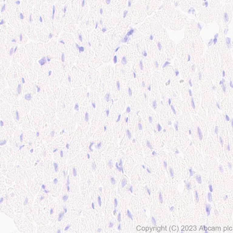Immunohistochemistry (Formalin/PFA-fixed paraffin-embedded sections) - Anti-Kir4.1/KCNJ10 antibody [EPR27251-74] - BSA and Azide free (AB312845)