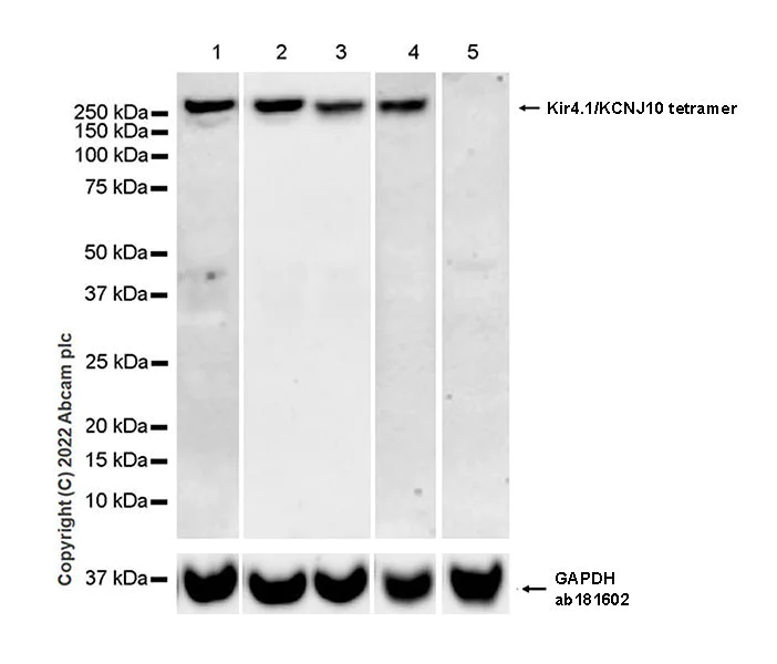 Western blot - Anti-Kir4.1/KCNJ10 antibody [EPR27251-79] (AB306550)