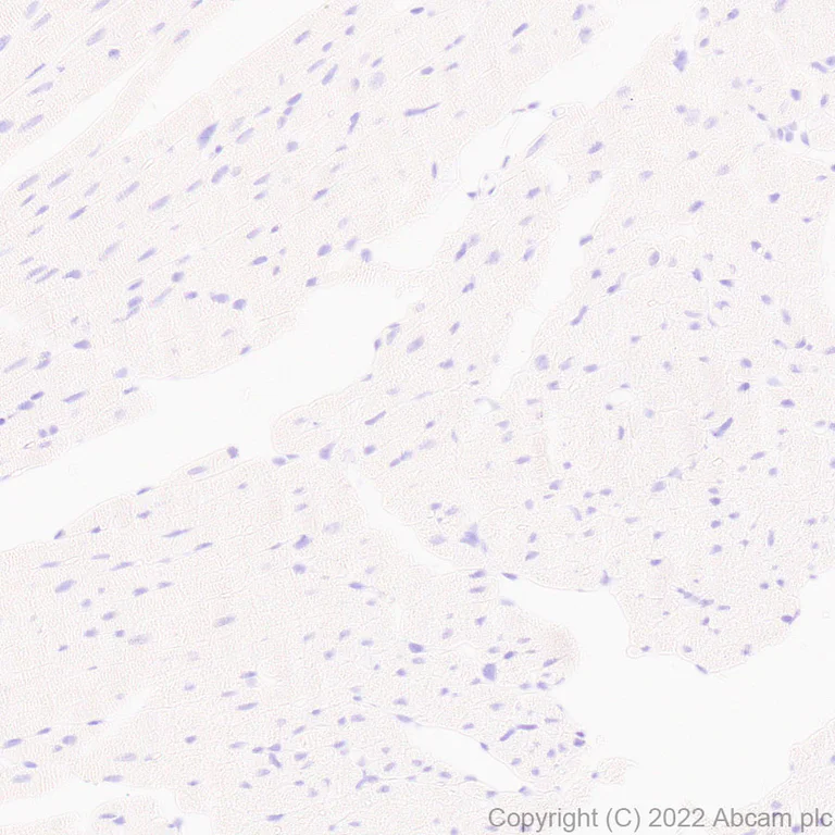 Immunohistochemistry - Anti-Kir4.1/KCNJ10 antibody [EPR27251-79] - BSA and Azide free (AB306551)