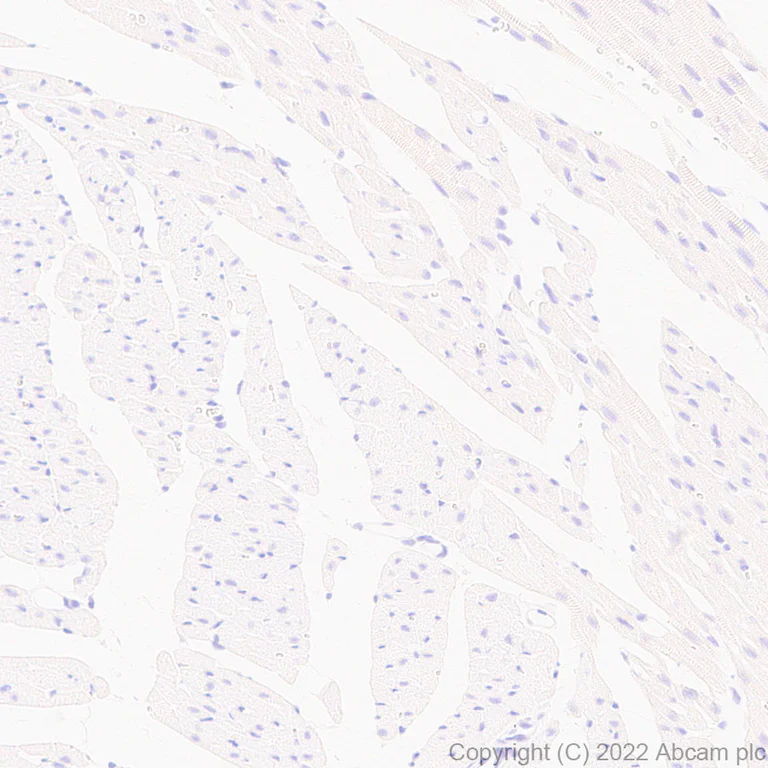 Immunohistochemistry - Anti-Kir4.1/KCNJ10 antibody [EPR27251-79] - BSA and Azide free (AB306551)