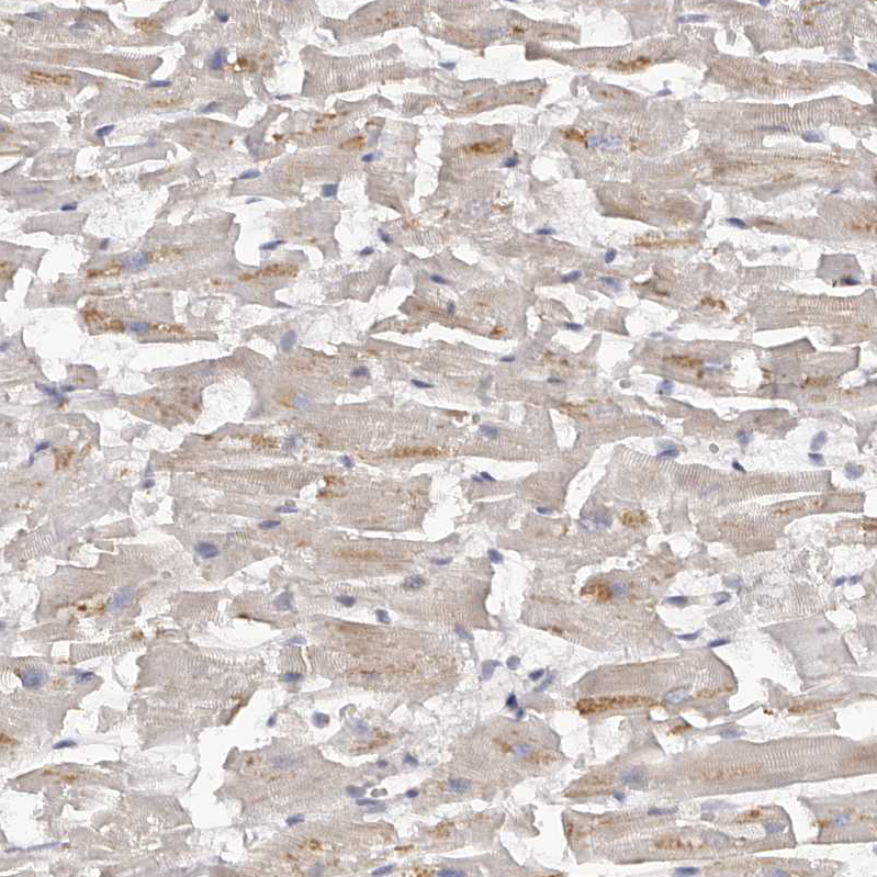 Immunohistochemistry (Formalin/PFA-fixed paraffin-embedded sections) - Anti-Kir6.1/KCNJ8 antibody (AB251809)