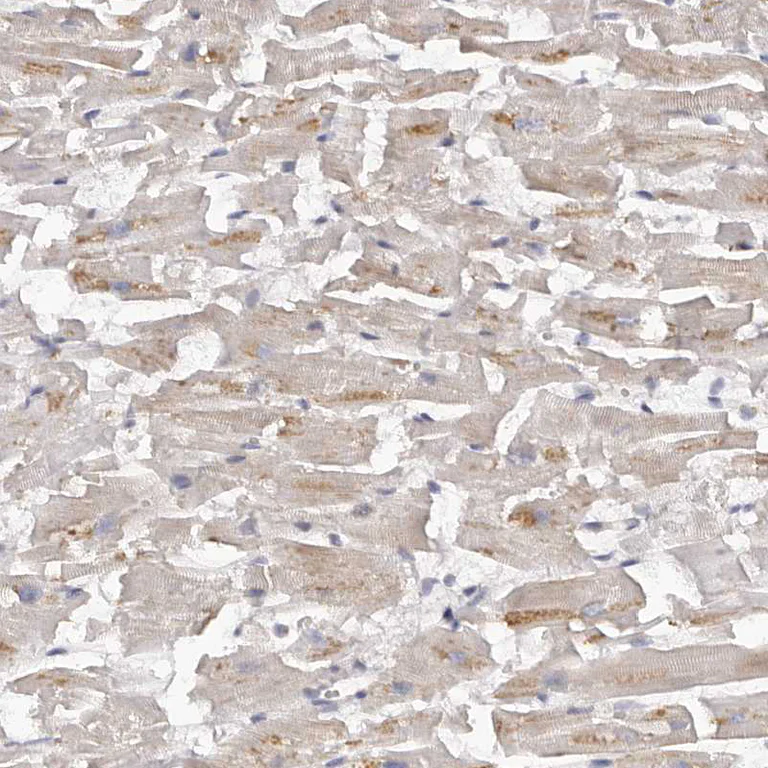Immunohistochemistry (Formalin/PFA-fixed paraffin-embedded sections) - Anti-Kir6.1/KCNJ8 antibody (AB251809)