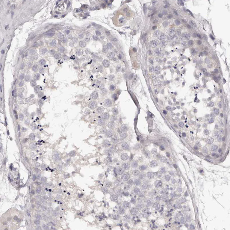 Immunohistochemistry (Formalin/PFA-fixed paraffin-embedded sections) - Anti-Kir6.1/KCNJ8 antibody (AB251809)