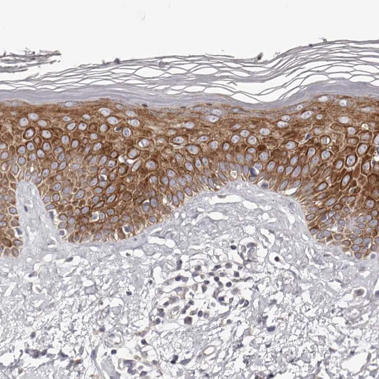 Immunohistochemistry (Formalin/PFA-fixed paraffin-embedded sections) - Anti-Kir6.1/KCNJ8 antibody (AB251809)