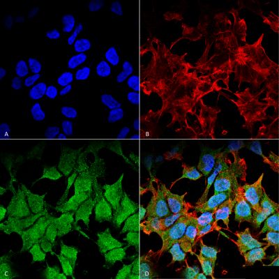 Immunocytochemistry/ Immunofluorescence - Anti-Kir6.1/KCNJ8 antibody [S366-60] (AB241996)