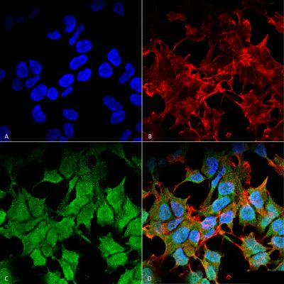 Immunocytochemistry/ Immunofluorescence - Anti-Kir6.1/KCNJ8 antibody [S366-60] (AB241996)