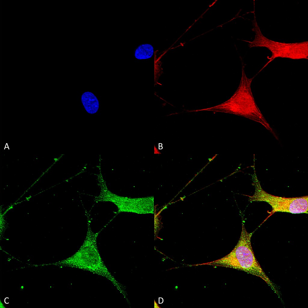 Immunocytochemistry/ Immunofluorescence - Anti-Kir6.1/KCNJ8 antibody [S366-60] (AB241996)