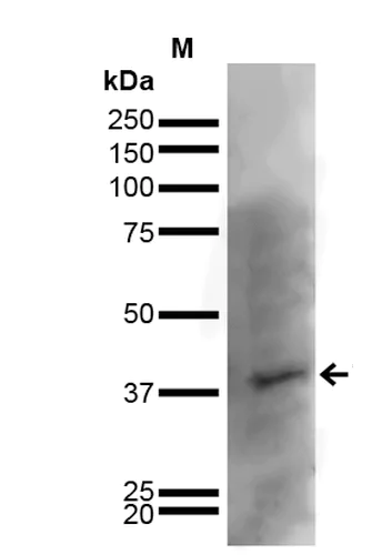 Western blot - Anti-Kir6.1/KCNJ8 antibody [S366-60] (AB241996)