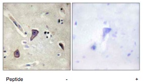 Immunohistochemistry (Formalin/PFA-fixed paraffin-embedded sections) - Anti-Kir6.2/BIR antibody (AB79171)