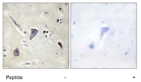 Immunohistochemistry (Formalin/PFA-fixed paraffin-embedded sections) - Anti-Kir6.2/BIR antibody (AB79171)