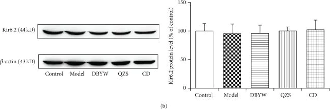 Western blot - Anti-Kir6.2/BIR antibody (AB79171)