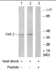 Western blot - Anti-Kir6.2/BIR antibody (AB79171)