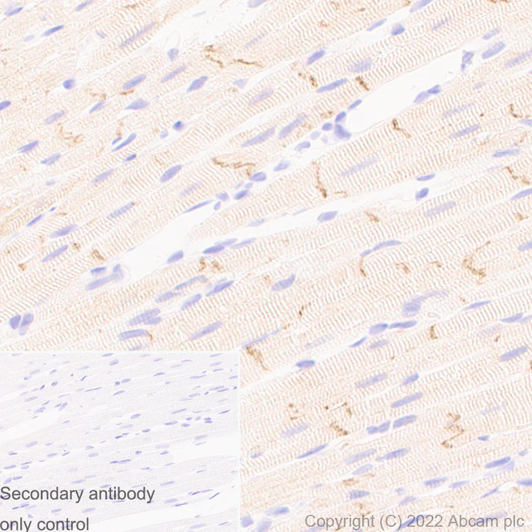 Immunohistochemistry (Formalin/PFA-fixed paraffin-embedded sections) - Anti-Kir6.2/BIR antibody [EPR25229-115] (AB291074)