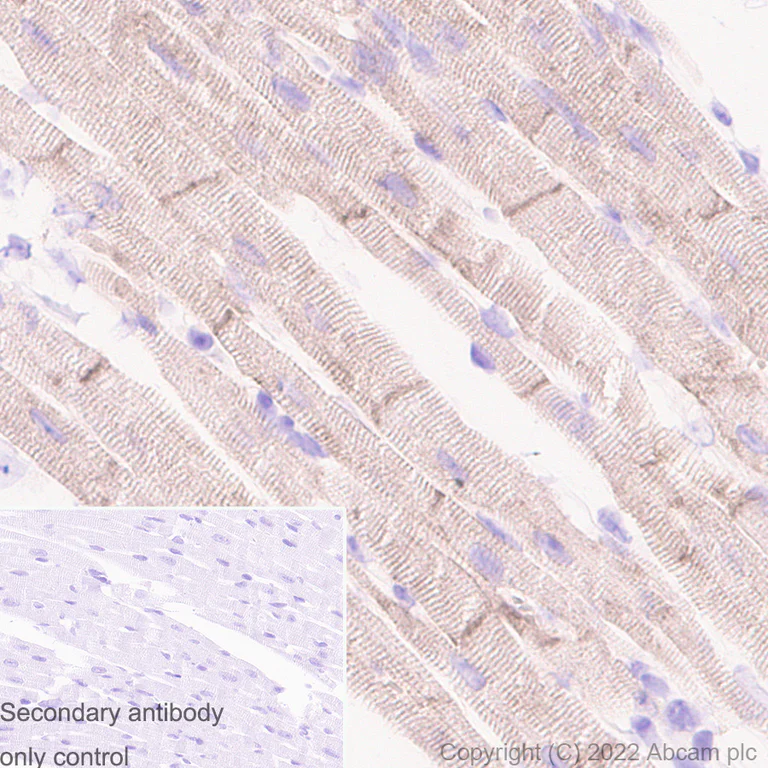 Immunohistochemistry - Anti-Kir6.2/BIR antibody [N363/71] - BSA and Azide free (AB307372)