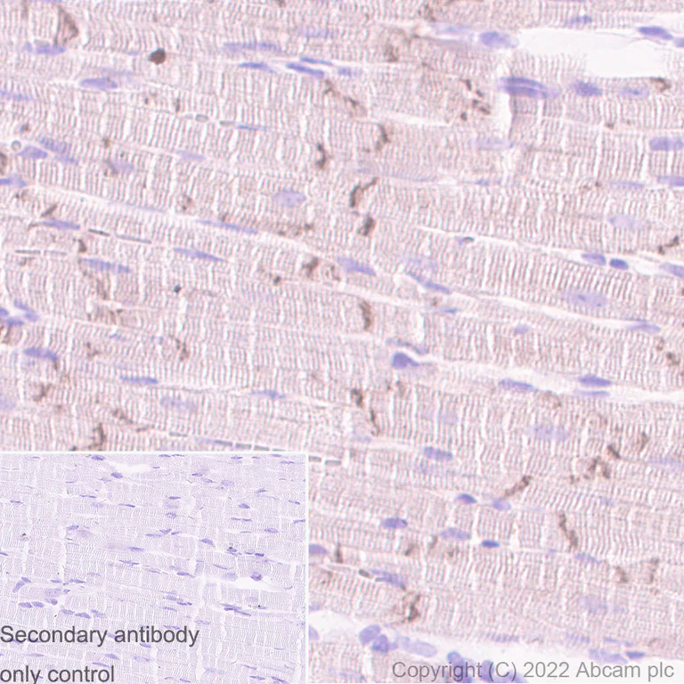 Immunohistochemistry - Anti-Kir6.2/BIR antibody [N363/71] - BSA and Azide free (AB307372)