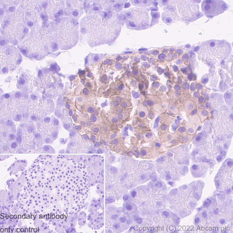Immunohistochemistry - Anti-Kir6.2/BIR antibody [N363/71] - BSA and Azide free (AB307372)